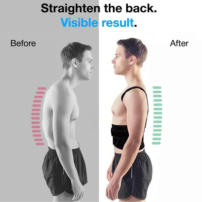 HZA™ | Adjustable Back and Shoulder Posture Corrector (Unisex)